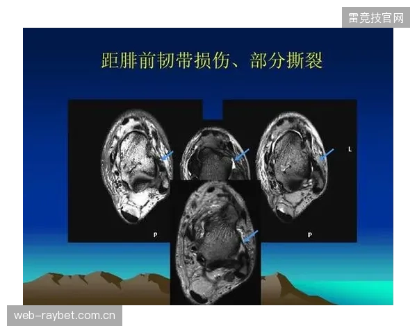 长春亚泰边路前压持续撕裂外侧